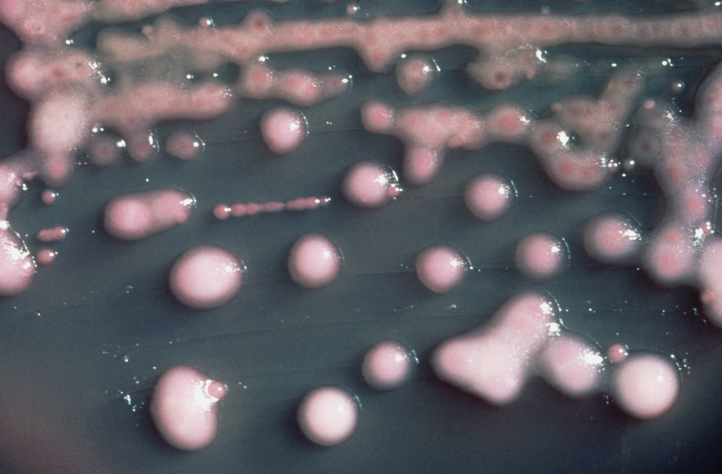 Gram-negative, small rod-shaped Klebsiella pneumoniae bacteria grown in agar culture. (Centre for Disease Control/Wikimedia Commons) Gram-negative, small rod-shaped Klebsiella pneumoniae bacteria grown in agar culture. (Centre for Disease Control/Wikimedia Commons)