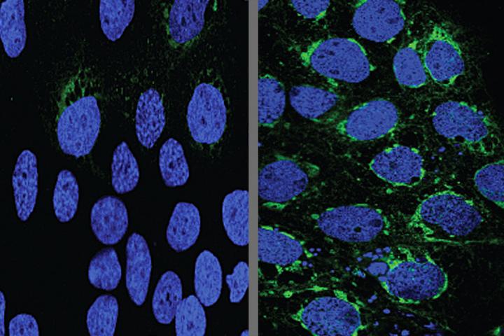 Human placental cells (blue) infected with Zika virus (green) responded to the malaria drug chloroquine (left). (Photo: Bin Cao/Washington University School of Medicine) Human placental cells (blue) infected with Zika virus (green) responded to the malaria drug chloroquine (left). (Photo: Bin Cao/Washington University School of Medicine)