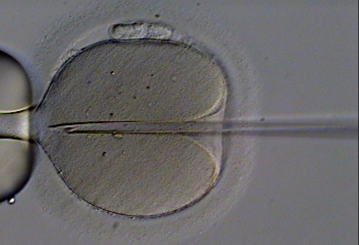 An immobilized ejaculated spermatozoon is inserted into a human oocyte. (Image: Eugene Ermolovich/Wikimedia Commons) An immobilized ejaculated spermatozoon is inserted into a human oocyte. (Image: Eugene Ermolovich/Wikimedia Commons)