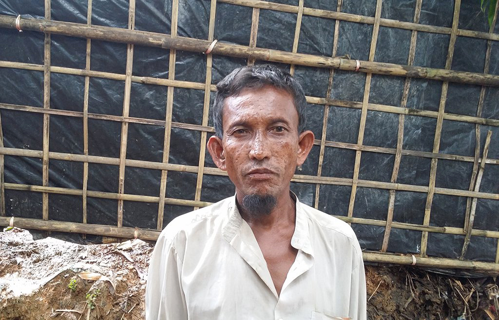 Hashu Mia, a Muslim refugee from Fakirabazar village. Photo credit: Mahadi Al Hasnat/Dhaka Tribune Hashu Mia, a Muslim refugee from Fakirabazar village. Photo credit: Mahadi Al Hasnat/Dhaka Tribune