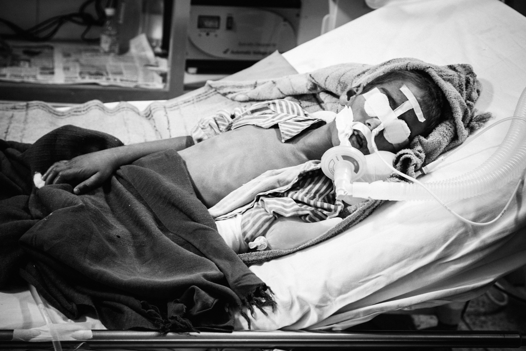 In the epidemic ward, some children strain to breathe even when they are on ventilators. Many are shrunken with their ribs sticking out. In the epidemic ward, some children strain to breathe even when they are on ventilators. Many are shrunken with their ribs sticking out.