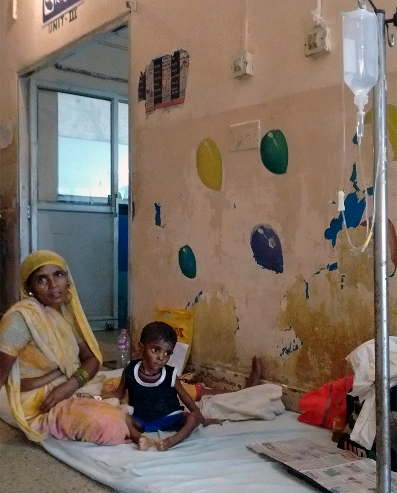 Three-year old Ibram has nephrotic syndrome, disease in which protein is lost through the kidneys, resulting in low blood protein levels and in water being drawn in tissues resulting in swelling. Ibram is severely underweight, and had been undergoing treatment for a week. His grandmother Jaina Bibi said the family came to RIMS after spending Rs 1.5 lakh for his treatment at a private hospital for 15 months during which Ibram showed little improvement. The fees at the private hospital were very steep Ibram’s father who works as a painter. At RIMS, the family spent Rs 100 everyday for two bottles of intravenous fluid bottles, though the hospital is supposed to provide this free of cost. Three-year old Ibram has nephrotic syndrome, disease in which protein is lost through the kidneys, resulting in low blood protein levels and in water being drawn in tissues resulting in swelling. Ibram is severely underweight, and had been undergoing treatment for a week. His grandmother Jaina Bibi said the family came to RIMS after spending Rs 1.5 lakh for his treatment at a private hospital for 15 months during which Ibram showed little improvement. The fees at the private hospital were very steep Ibram’s father who works as a painter. At RIMS, the family spent Rs 100 everyday for two bottles of intravenous fluid bottles, though the hospital is supposed to provide this free of cost.