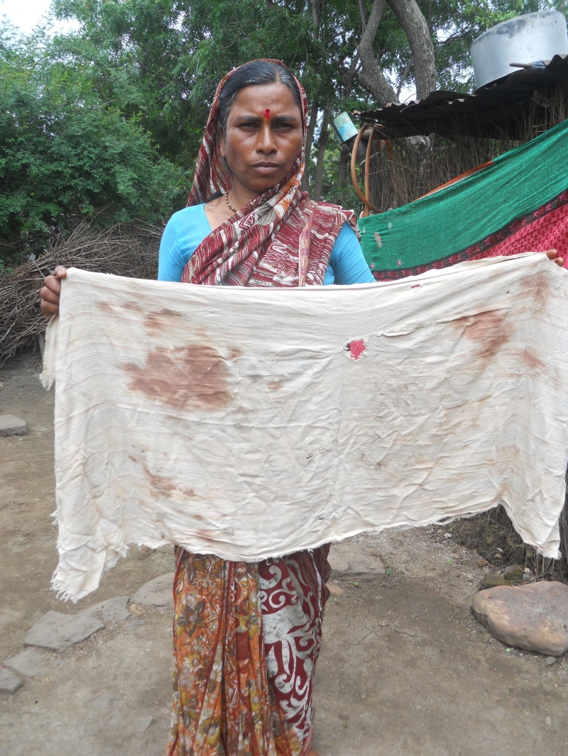 Aruna Dahire with a blood-stained towel from the day she was beaten. (Photo credit: Rahi Gaikwad). Aruna Dahire with a blood-stained towel from the day she was beaten. (Photo credit: Rahi Gaikwad).