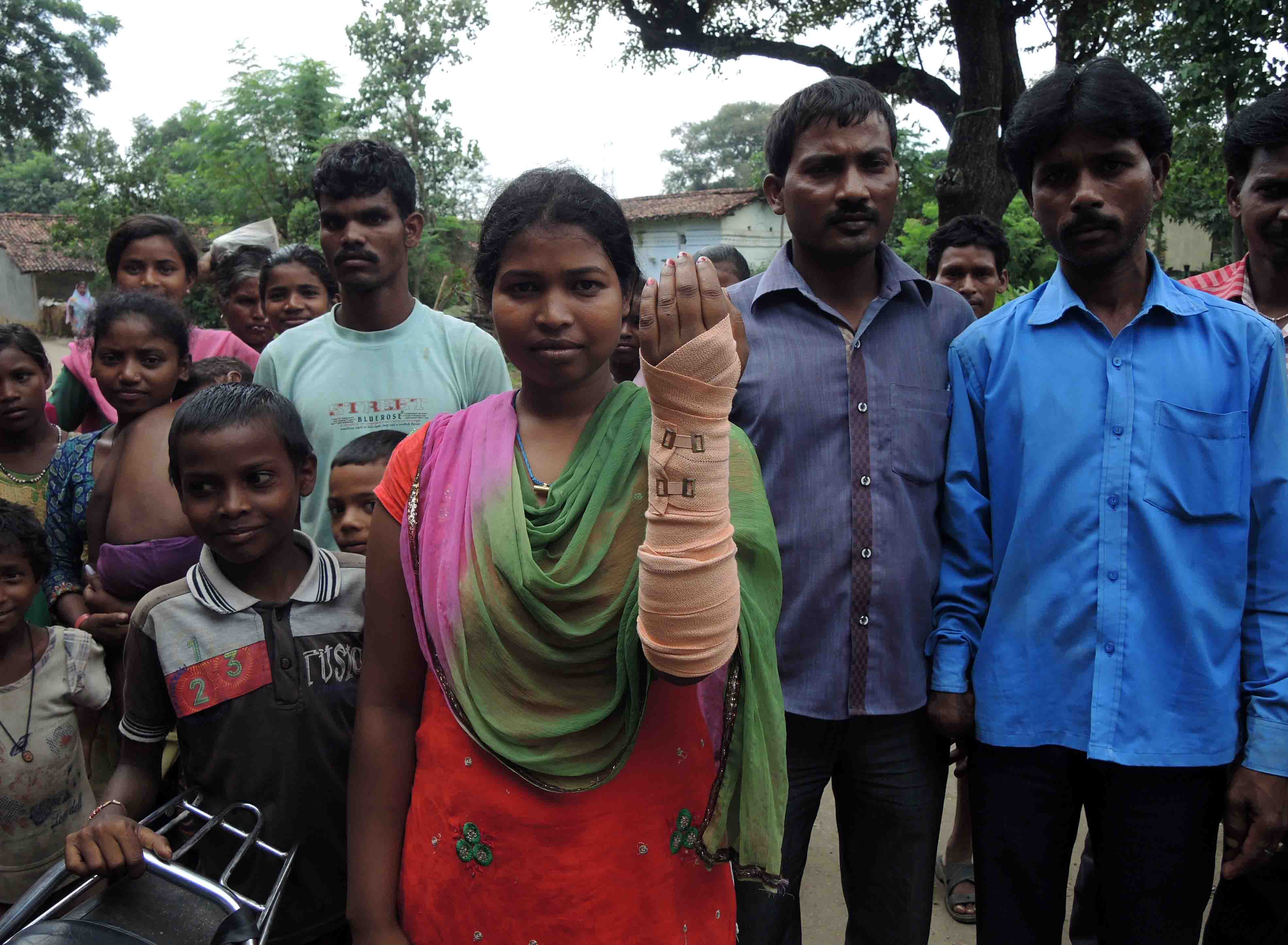Meena Kumari was injured in the clashes. Credit: Manob Chowdhury Meena Kumari was injured in the clashes. Credit: Manob Chowdhury