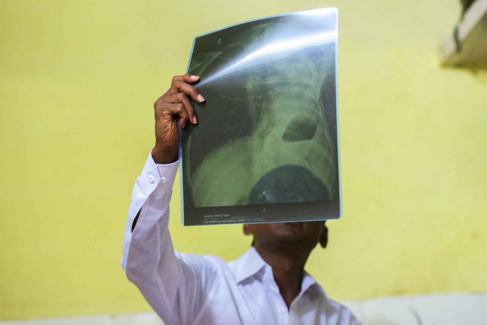 Owais examines his scans. (Photo: Somya Parikh) Owais examines his scans. (Photo: Somya Parikh)