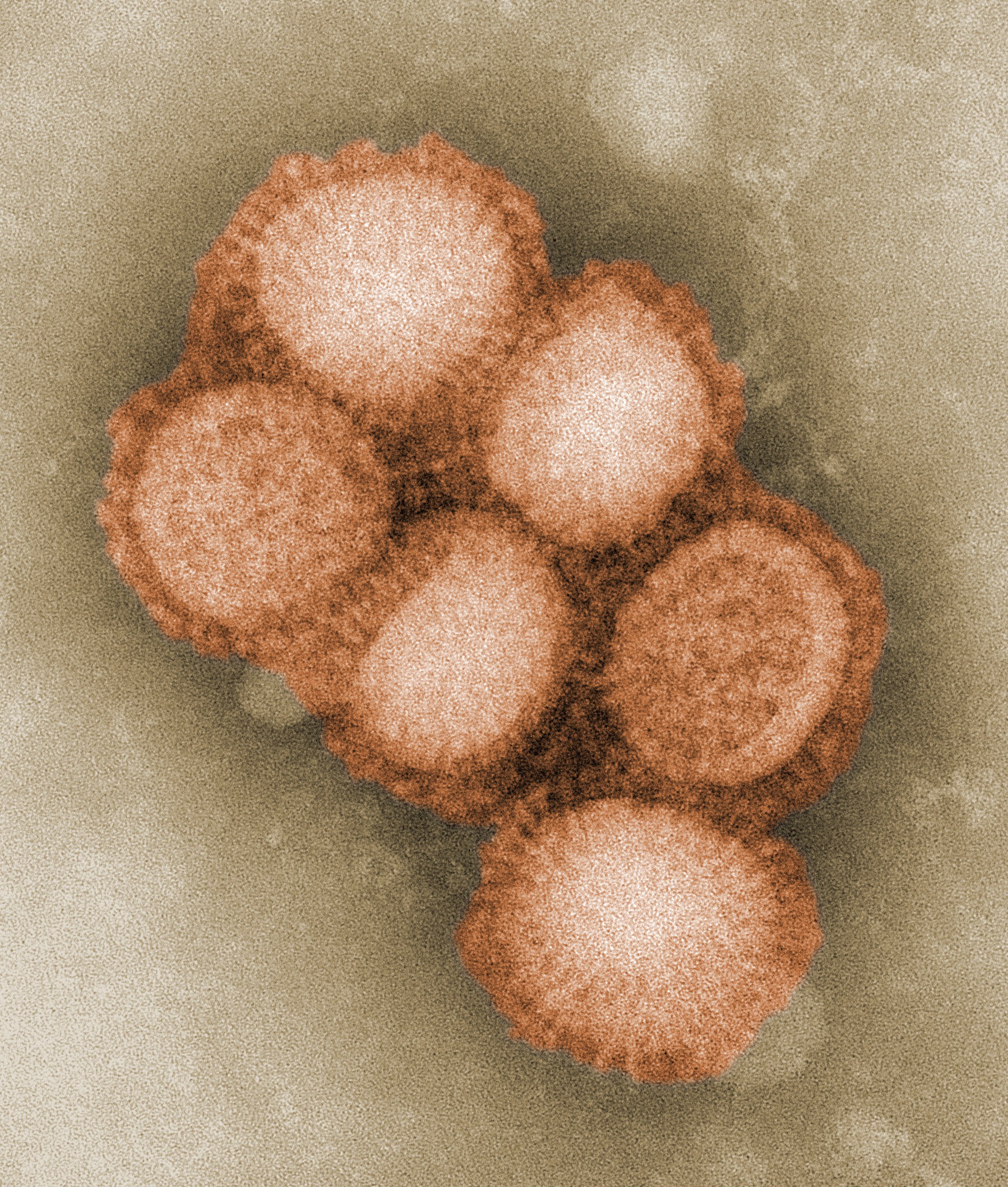 An electron micrograph image showing some of the ultrastructural morphology of the A/CA/4/09 swine flu virus. (Image: CDC/Wikimedia Commons) An electron micrograph image showing some of the ultrastructural morphology of the A/CA/4/09 swine flu virus. (Image: CDC/Wikimedia Commons)