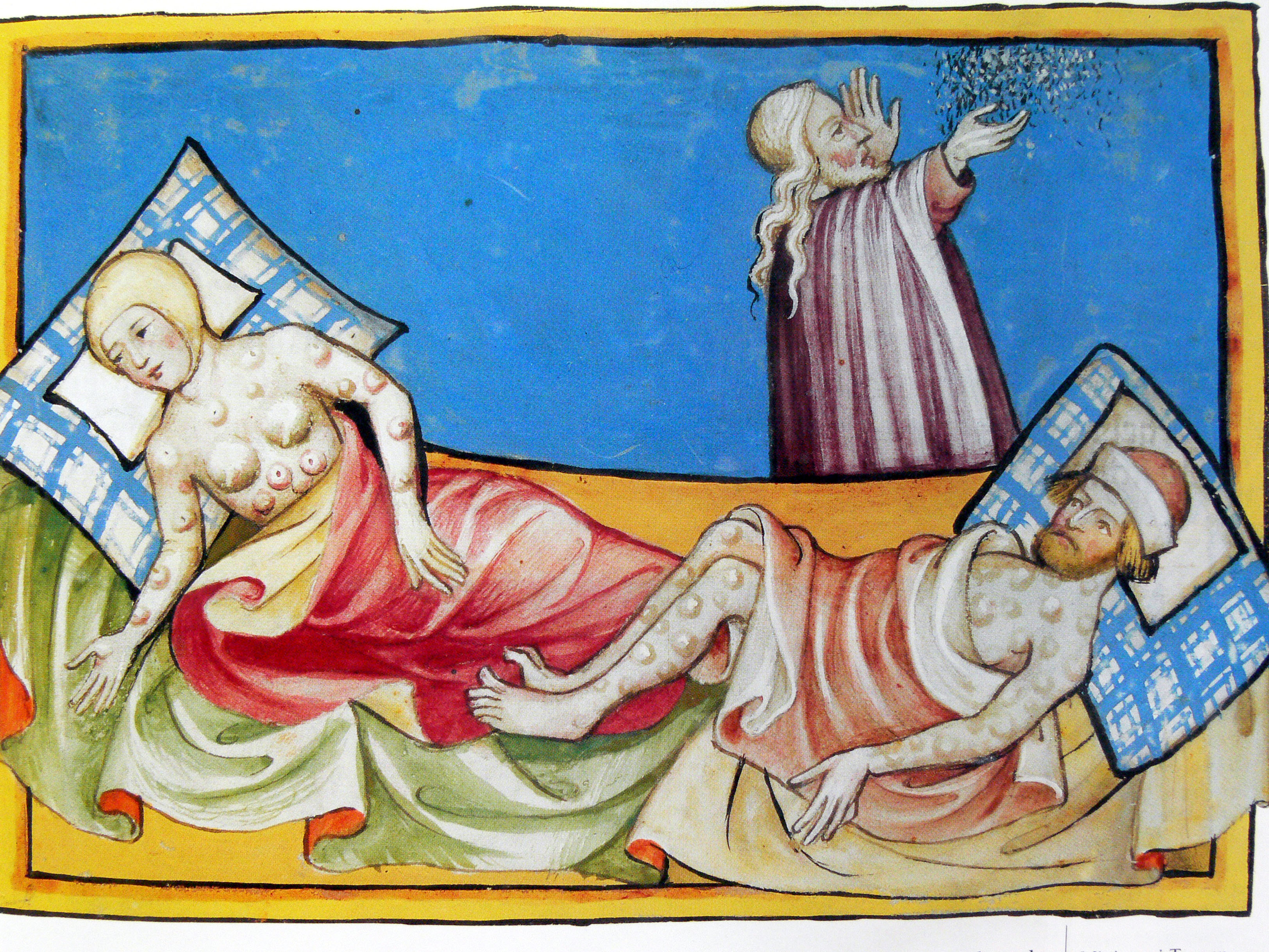 Miniature out of the Toggenburg Bible (Switzerland) of 1411, which has been widely interpreted as representing the outbreak of bubonic plague in Europe, but might actually show people suffering from smallpox as the bubonic plague normally causes blisters only in the groin and armpits. (Image: Wikimedia Commons) Miniature out of the Toggenburg Bible (Switzerland) of 1411, which has been widely interpreted as representing the outbreak of bubonic plague in Europe, but might actually show people suffering from smallpox as the bubonic plague normally causes blisters only in the groin and armpits. (Image: Wikimedia Commons)