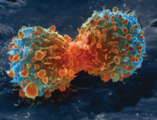 Lung cancer cell during cell division. (Image: National Institutes of Health/Wikimedia Commons) Lung cancer cell during cell division. (Image: National Institutes of Health/Wikimedia Commons)