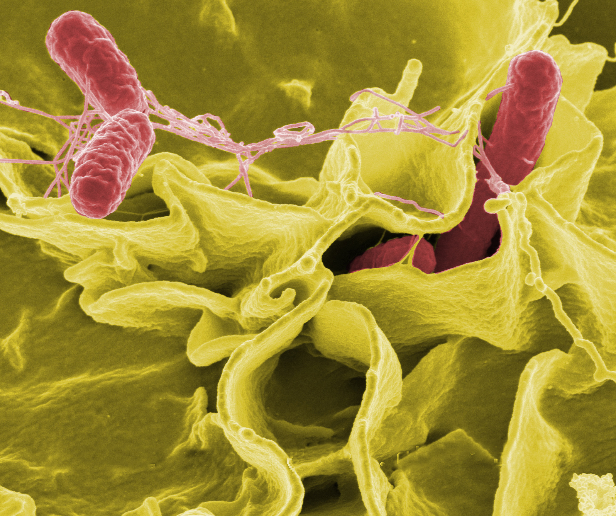 Color-enhanced scanning electron micrograph showing Salmonella Typhimurium (red) invading cultured human cells. (Image: Rocky Mountain Laboratories, NIAID, NIH/Wikimedia Commons) Color-enhanced scanning electron micrograph showing Salmonella Typhimurium (red) invading cultured human cells. (Image: Rocky Mountain Laboratories, NIAID, NIH/Wikimedia Commons)