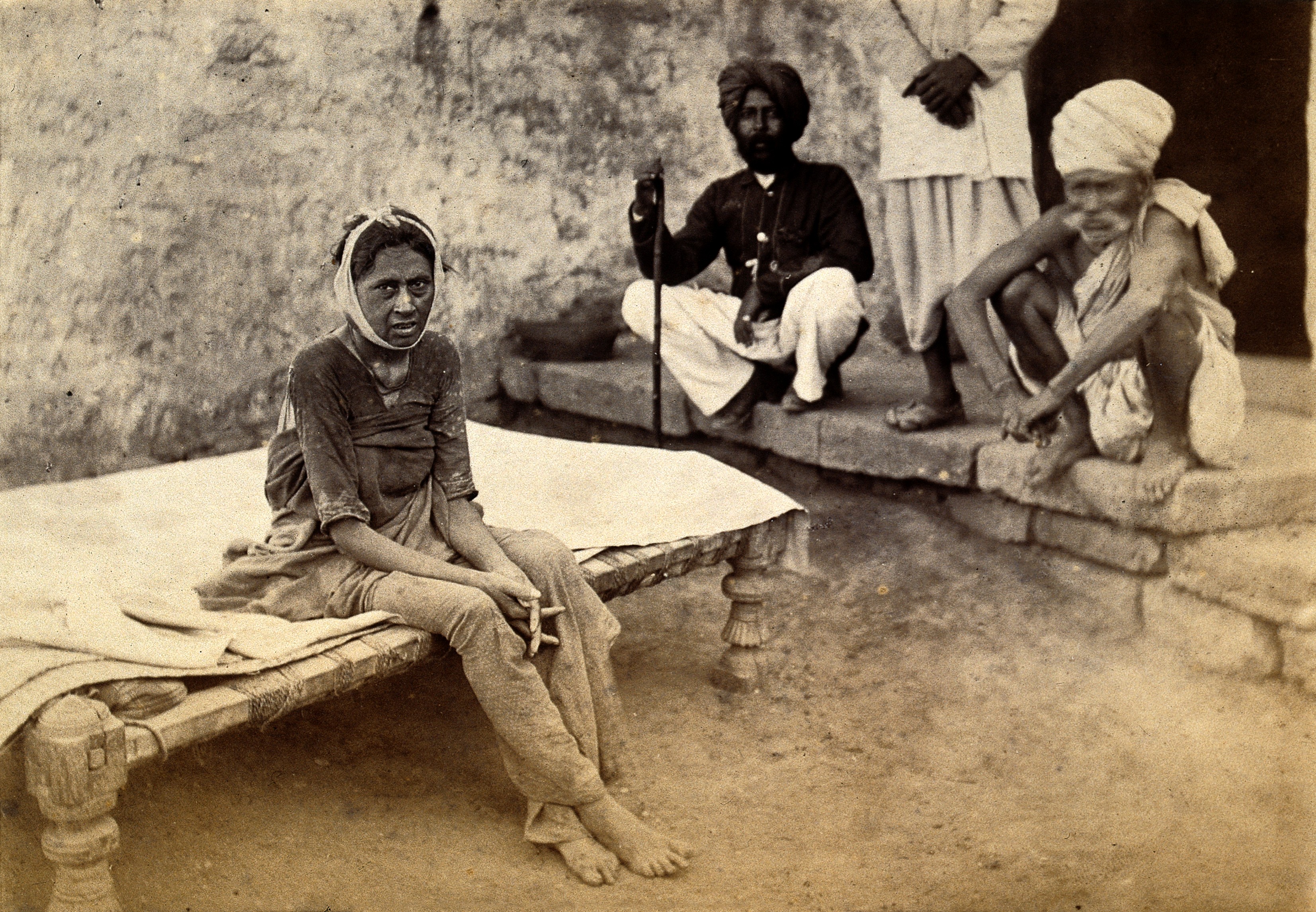 A patient in Karachi suffering bubonic plague in 1882 when the disease spread from Bombay. (Photo: Wellcome Library, London/Wikimedia Commons) A patient in Karachi suffering bubonic plague in 1882 when the disease spread from Bombay. (Photo: Wellcome Library, London/Wikimedia Commons)