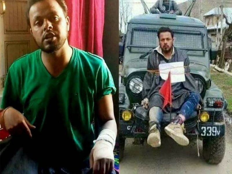 Farooq Ahmed Dar, the Kashmiri who was used as a human shield by the Army. Farooq Ahmed Dar, the Kashmiri who was used as a human shield by the Army.