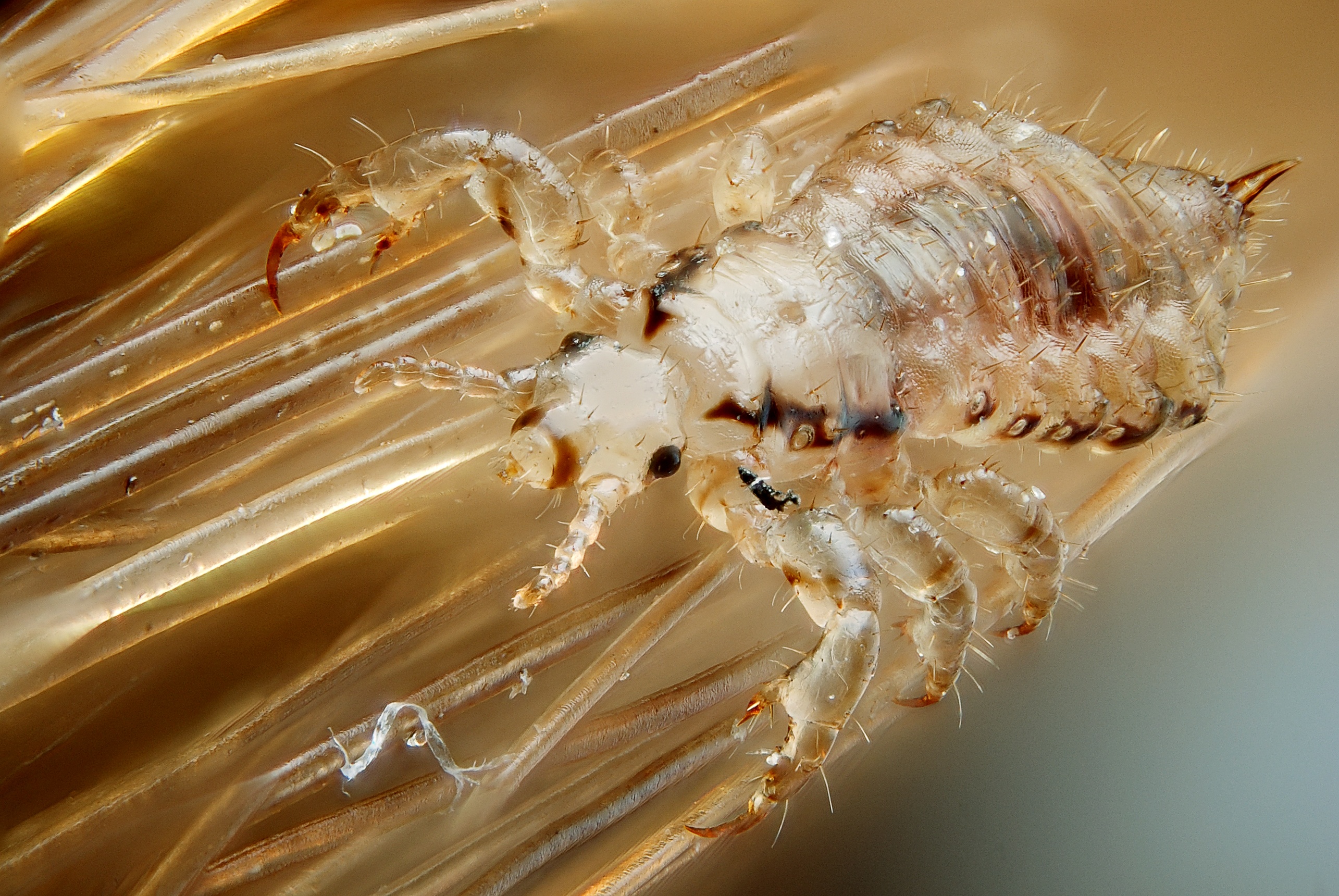 Male human head louse. (Photo: Gilles San Martin/Flickr) Male human head louse. (Photo: Gilles San Martin/Flickr)