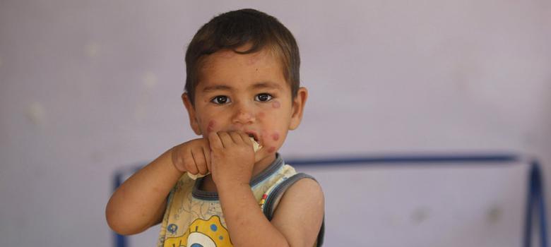 Explainer: What is the 'flesh-eating' disease that's spreading across Syria