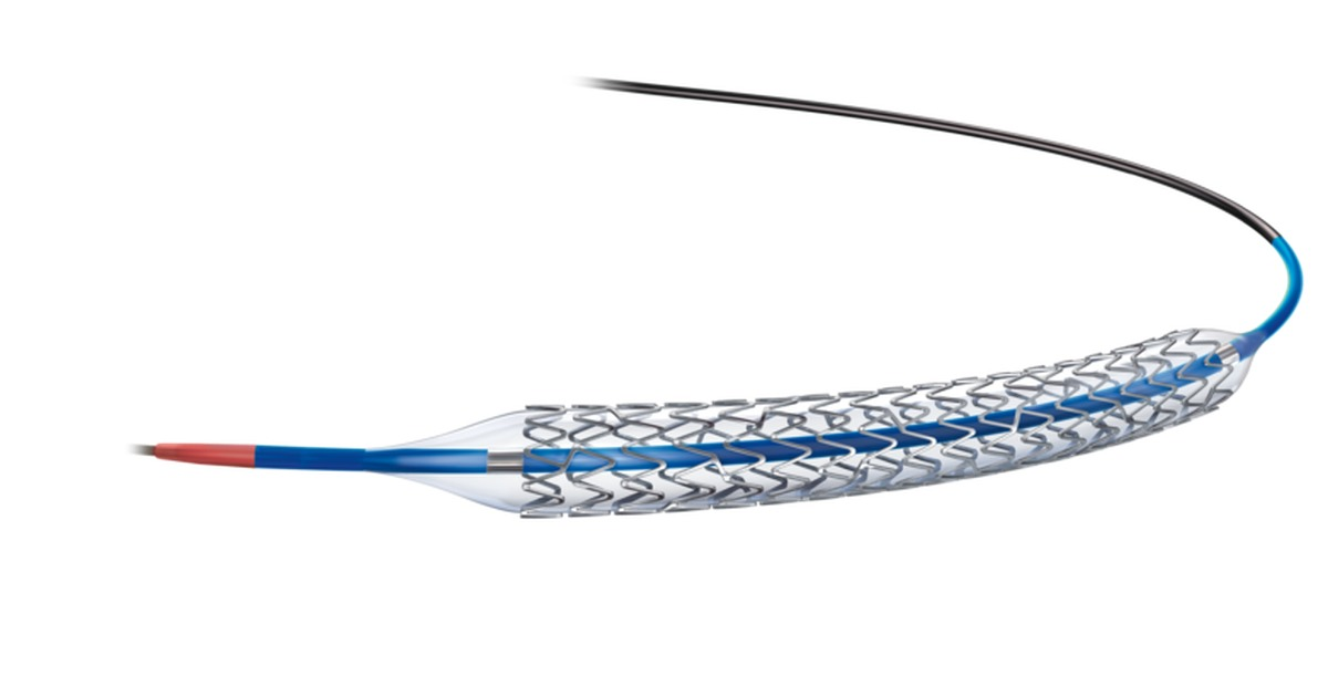 Ceiling price of coronary stent could drop to between Rs 21,881 and Rs 67,272