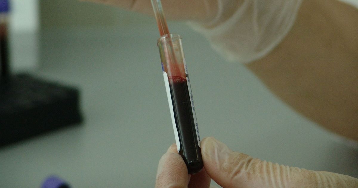 In Gujarat, government tested blood samples for Zika virus but told patients it was for malaria