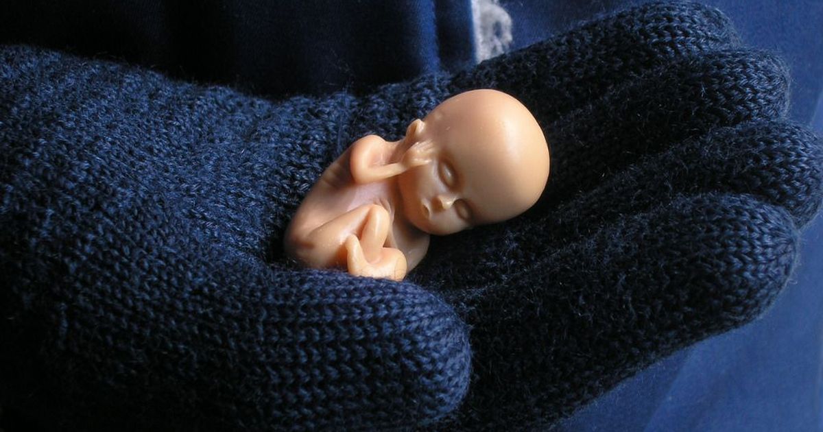 Supreme Court orders Chandigarh to set up Rs 10-lakh fund for 10-year-old who gave birth to a baby