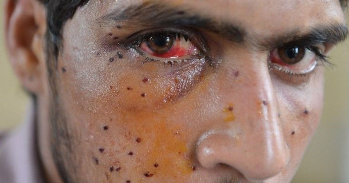 Kashmir: Police order admits misuse of pump action guns against protestors, says report